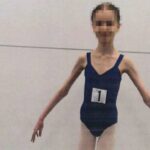 Важила всього 27 кілограмів: в Австралії батьки роками морили голодом доньку-балерину