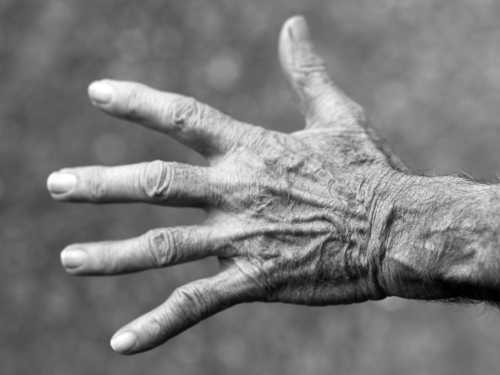 Слабкість м'язів у літніх людей – це саркопенія. Як можна запобігти її трагічним наслідкам? - INFBusiness