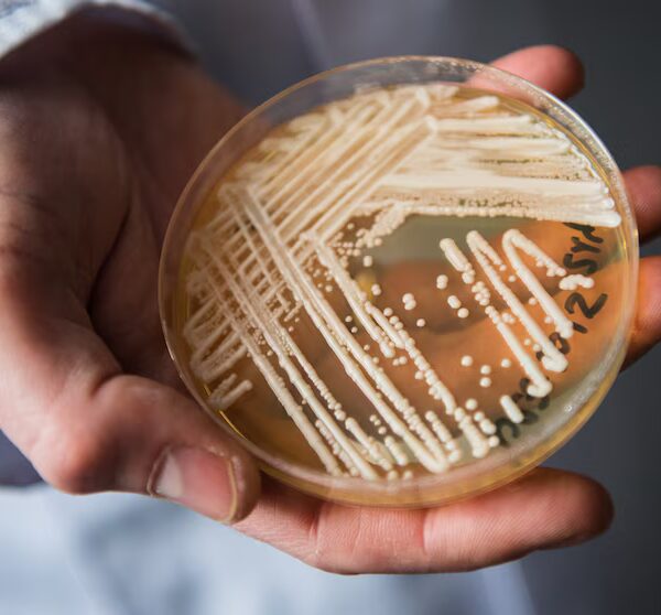 CDC: Грибок Candida auris виявлено у 27 штатах США