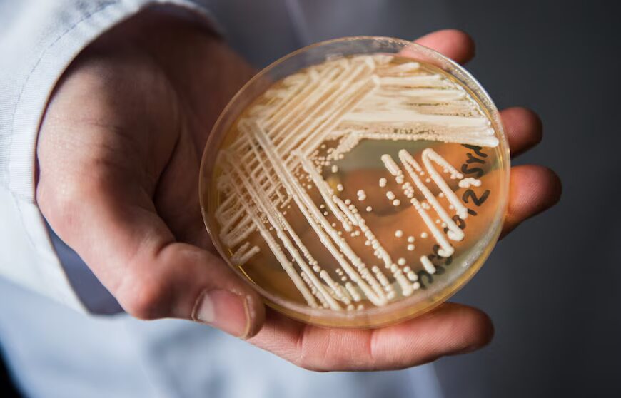CDC: Грибок Candida auris виявлено у 27 штатах США